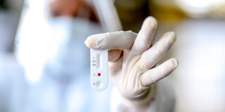 Piauí não registra óbitos por Covid-19 há uma semana, diz Sesapi