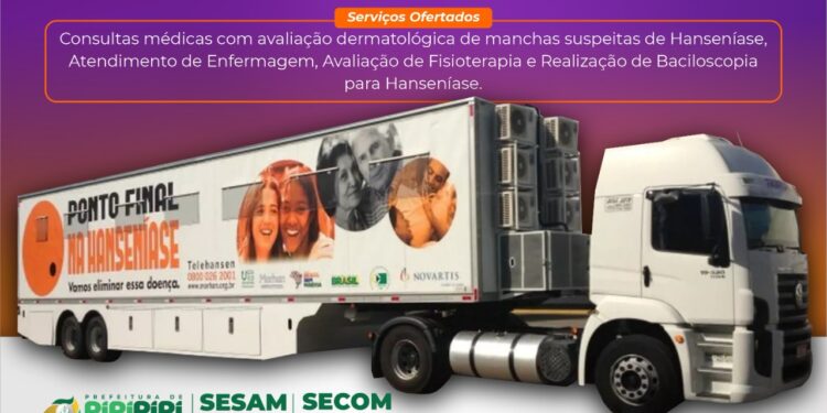 Piripiri receberá a Carreta da Saúde de combate à Hanseníase na próxima segunda, dia 23