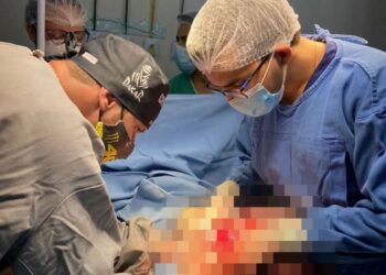 Médicos removem tumores de quase 11 kg de paciente no Piauí