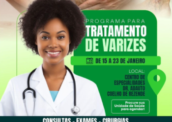 Programa para tratamento de varizes inicia em Piripiri