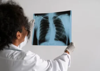 Dia Mundial da Tuberculose:A data é marcada pela conscientização sobre os desafios no controle dessa doença